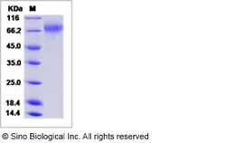 Sino Biological Influenza A H3N2 (A/Hong Kong/CUHK31987/2011) Hemagglutinin