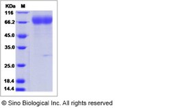 Sino Biological Influenza A H3N2 (A/Hong Kong/CUHK31987/2011) Hemagglutinin