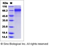 Sino Biological Influenza A H3N2 (A/Sydney/5/1997) Hemagglutinin / HA Protein