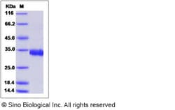 Sino Biological SARS-CoV Spike/RBD Protein (RBD, His Tag), Quantity: Each