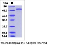 Sino Biological Influenza A H3N2 (A/Victoria/208/2009) Hemagglutinin /