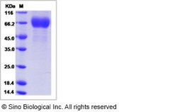 Sino Biological Influenza A H3N2 (A/Victoria/208/2009) Hemagglutinin /