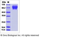Sino Biological Influenza A H3N2 (A/Guangdong-Luohu/1256/2009) Hemagglutinin