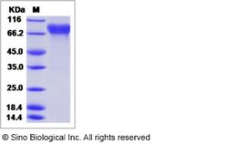 Sino Biological Influenza A H3N2 (A/Babol/36/2005) Hemagglutinin / HA Protein