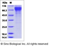 Sino Biological Influenza A H3N2 (A/Babol/36/2005) Hemagglutinin / HA0