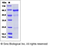 Sino Biological Influenza A H5N1 (A/barnswallow/HongKong/D10-1161/2010)