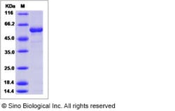 Sino Biological Influenza A H5N8 (A/turkey/Ireland/1378/1983) Hemagglutinin