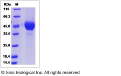 Sino Biological Influenza A H6N8 (A/mallard/Ohio/217/1998) Hemagglutinin