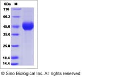 Sino Biological Influenza A H7N1 (A/turkey/Italy/4602/99) Hemagglutinin