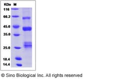 Sino Biological Influenza A H7N7 (A/equine/Kentucky/1a/1975) Hemagglutinin