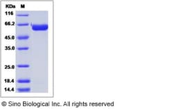 Sino Biological Influenza A H9N2 (A/Hong Kong/35820/2009) Hemagglutinin