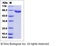 Sino Biological Influenza A H9N2 (A/Hong Kong/3239/2008) Hemagglutinin