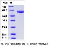 Sino Biological Influenza A H9N5 (A/shorebird/DE/261/2003) Hemagglutinin