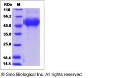 Sino Biological Influenza A H9N5 (A/shorebird/DE/261/2003) Hemagglutinin