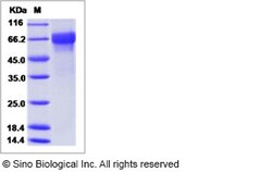 Sino Biological Influenza B (B/Massachusetts/03/2010) Hemagglutinin / HA