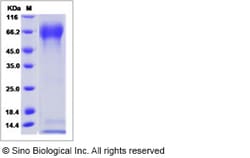 Sino Biological Influenza B (B/Massachusetts/03/2010) Hemagglutinin Protein