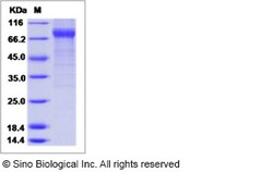 Sino Biological Influenza B (B/Massachusetts/03/2010) Hemagglutinin / HA0