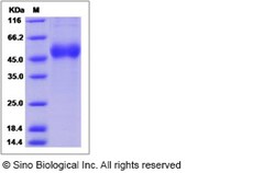 Sino Biological Influenza A H15N2 (A/Australian shelduck/Western Australia/1756/1983)