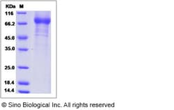 Sino Biological Influenza A H1N1 (A/USSR/90/1977) Neuraminidase / NA (His