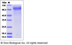 Sino Biological Influenza A H3N2 (A/Aichi/2/1968) Neuraminidase / NA (His