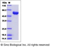 Sino Biological Influenza A H1N1 (A/California/07/2009) Nucleoprotein /