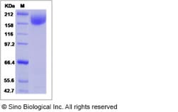 Sino Biological HIV-1 gp140 Protein (group M, subtype A, strain 92UG037.1)