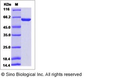Sino Biological HIV-p51 / RT-p51 (group M, subtype B (isolate HXB2) Gag-Pol