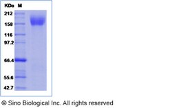 Sino Biological Human immunodeficiency virus 1 (HIV-1) (group M, subtype