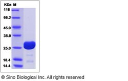 Sino Biological HIV-1 p24 Protein (group O, strain BCF06) (His Tag), Quantity: