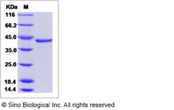 Sino Biological Hepatitis C virus (HCV-1a) NS3 protease / helicase immunodominant