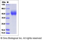 Sino Biological Ebola virus EBOV (subtype Zaire, strain Mayinga 1976) GP-RBD