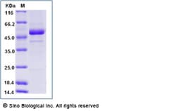 Sino Biological Rift Valley fever virus (RVFV) (strain MP12) glycoprotein