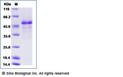 Sino Biological Rift Valley fever virus (RVFV) (strain MP12) glycoprotein