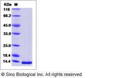 Sino Biological West Nile Virus (WNV) (lineage 1, strain NY99) E / Envelope