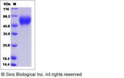 Sino Biological Influenza A H1N1 (A/California/06/2009) Hemagglutinin /