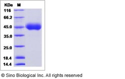 Sino Biological Influenza A H10N8 (A/duck/Guangdong/E1/2012) Hemagglutinin