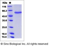 Sino Biological Influenza A H10N8 (A/duck/Guangdong/E1/2012) Neuraminidase