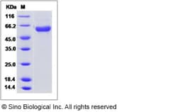Sino Biological Influenza A H10N8 (A/Jiangxi-Donghu/346/2013) Hemagglutinin