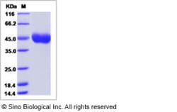 Sino Biological Influenza A H10N8 (A/Jiangxi-Donghu/346/2013) Hemagglutinin