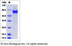 Sino Biological Influenza A H10N8 (A/Jiangxi-Donghu/346/2013) Hemagglutinin