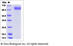 Sino Biological Ebola virus EBOV (subtype Bundibugyo, strain Uganda 2007)