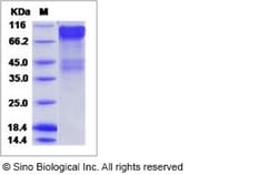 Sino Biological Ebola virus EBOV (subtype Bundibugyo, strain Uganda 2007)
