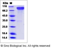 Sino Biological Epstein-Barr virus (Herpesvirus 4) EBV Glycoprotein gp350