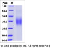 Sino Biological Hepatitis C virus Envelope Glycoprotein E1 / HCV-E1 (subtype