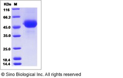 Sino Biological Influenza A H5N8 (A/breeder duck/Korea/Gochang1/2014) Hemagglutinin
