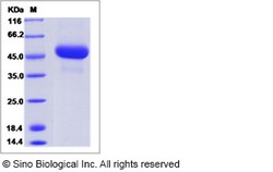 Sino Biological Influenza A H5N8 (A/broiler duck/Korea/Buan2/2014) Hemagglutinin