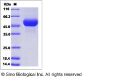 Sino Biological Influenza A H5N8 (A/duck/Zhejiang/W24/2013) Hemagglutinin