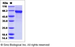 Sino Biological Influenza A H1N1 (A/NewJersey/8/1976) Hemagglutinin / HA