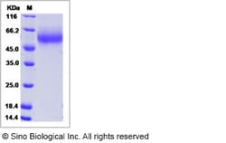 Sino Biological Influenza A H1N1 (A/Swine/Wisconsin/136/1997) Hemagglutinin