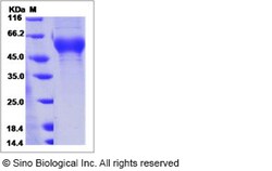 Sino Biological Influenza A H3N2 (A/Indiana/07/2012) Hemagglutinin / HA1